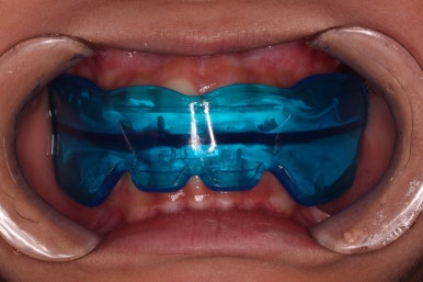 부산어린이교정