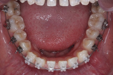 부산치아교정치과