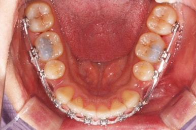 연산동교정치과