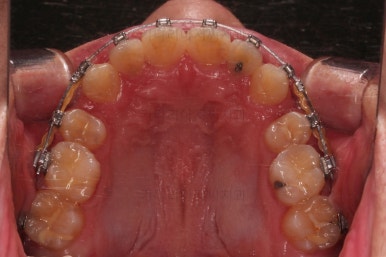 부산교정치과추천