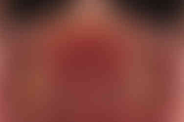 부산교정치과추천