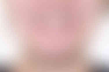 부산앞니부분교정