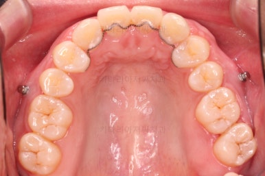 연산동교정치과