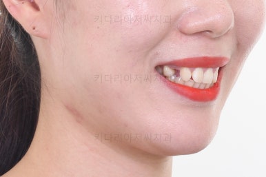 연산동교정치과