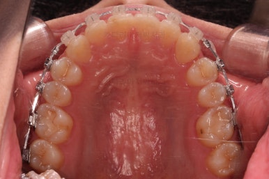 부산교정치과추천