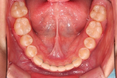 부산청소년교정치과