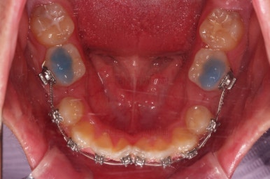 부산교정치과추천