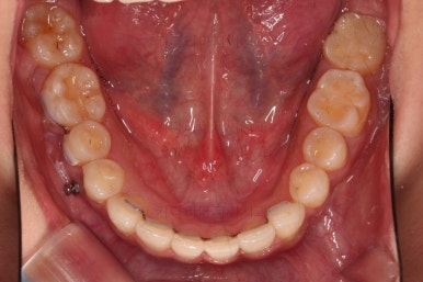 연산동교정치과