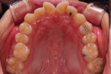 부산교정치과추천