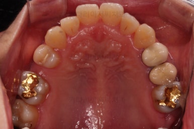 부산연산동치과