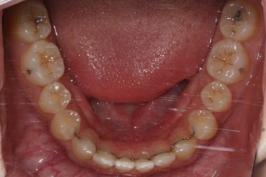 부산치아교정치과