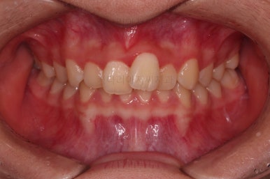 부산청소년교정치과