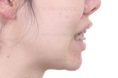 부산재교정치과