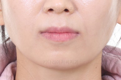 부산인비절라인