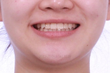 연산동교정치과