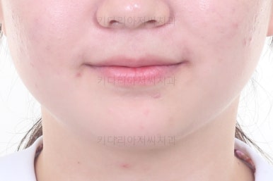 부산치아교정잘하는곳