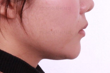 부산치아교정치과
