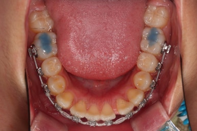 부산치아교정치과