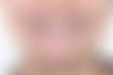 부산치아교정잘하는곳