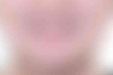 부산연산동사랑니발치