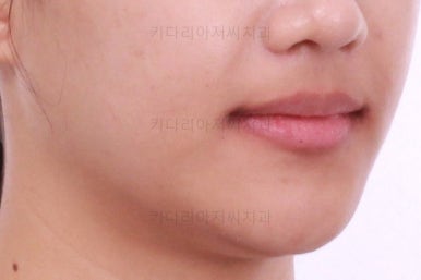 연산동치아교정치과