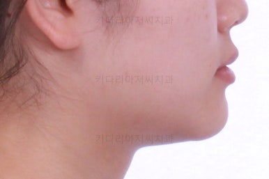 연산동교정치과