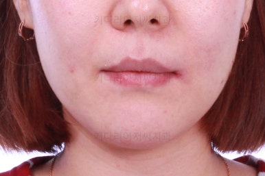 연산동교정치과