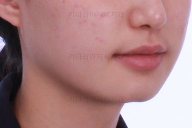 동래구치아교정