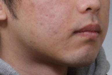 부산주걱턱교정