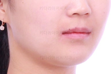 부산치아교정치과