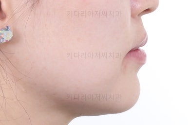 연산동교정치과