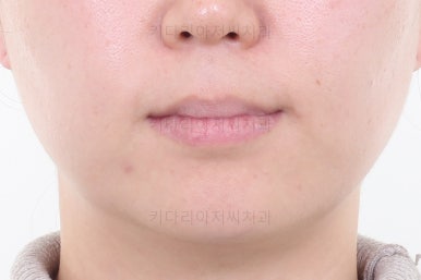 부산연산동치과