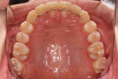 연산동교정치과