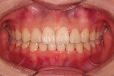 부산교정전문의