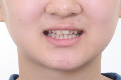 부산청소년교정치과