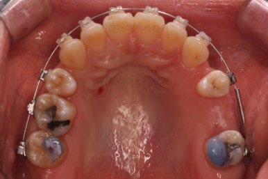 부산재교정치과