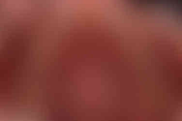 부산임플란트교정