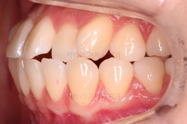 부산교정전문의