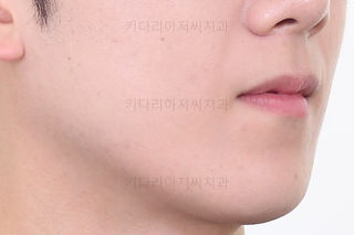 부산치아교정