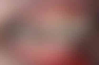 부산연산동교정치과