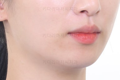 부산연산동부분교정