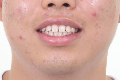 부산교정치과