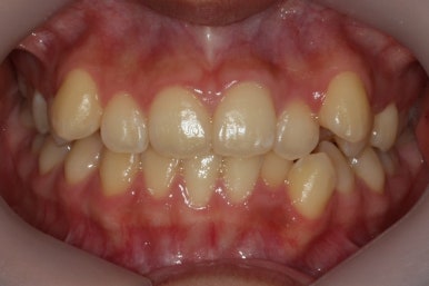 부산교정전문의