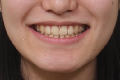 부산교정전문의