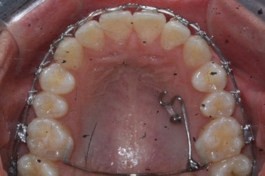 부산연산동청소년교정