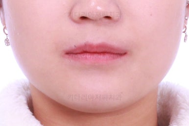 부산치아교정치과