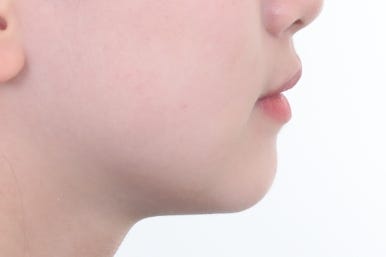 부산치아교정잘하는곳