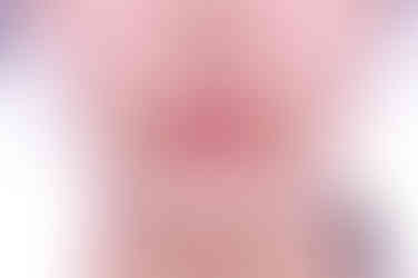 부산부분치아교정