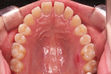 부산교정치과추천