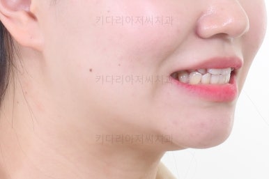 부산교정전문의